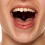 Infiammazione del palato: cause, sintomi e rimedi efficaci