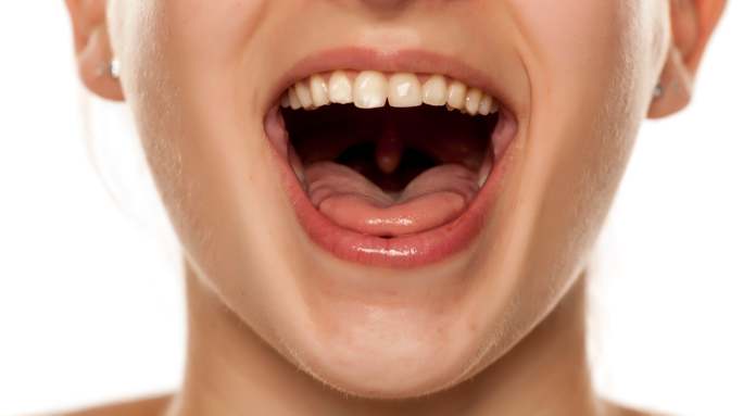 Infiammazione del palato: cause, sintomi e rimedi efficaci