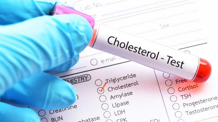 Colesterolo: la prevenzione con le statine inizia già a 30 anni