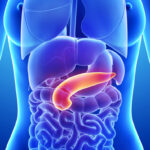 Tumore al pancreas: casi in aumento, quali sono i sintomi?