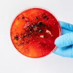 Sepsi: la sindrome invisibile che uccide 50.000 persone all’anno. L’intervista al prof. Antonelli