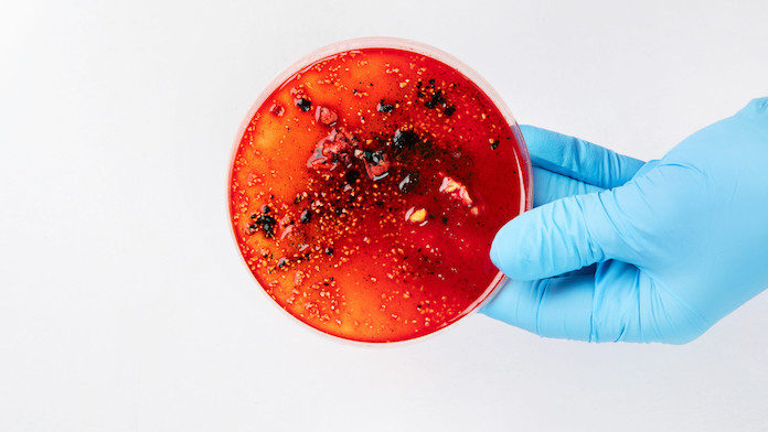 Sepsi: la sindrome invisibile che uccide 50.000 persone all’anno. L’intervista al prof. Antonelli